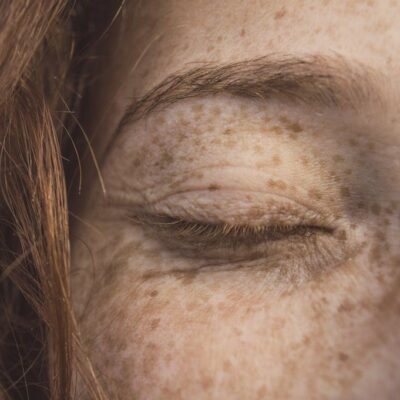 On Accepting Freckles and Other Unchangeables