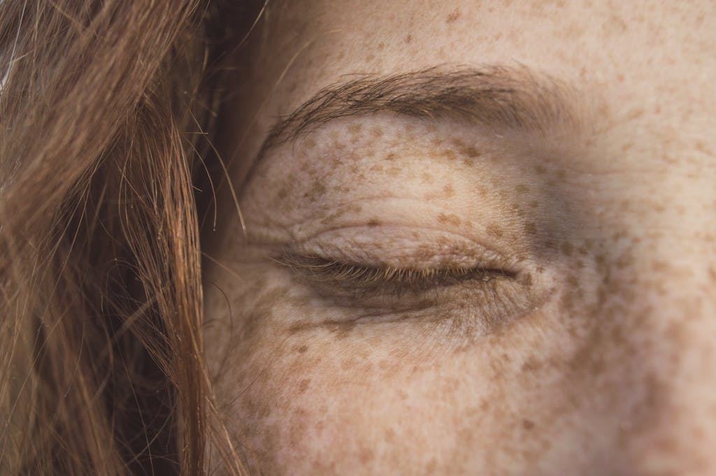 On Accepting Freckles and Other Unchangeables